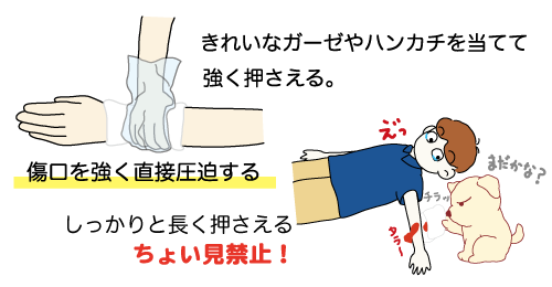 直接圧迫止血法