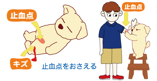 間接圧迫止血法