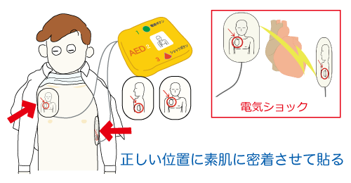 電極パッド
